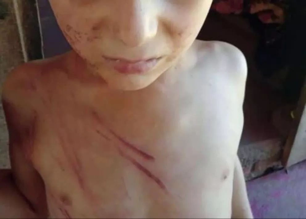 El Soberbio: vecinos asistieron a un menor que fue brutalmente golpeado por su madre